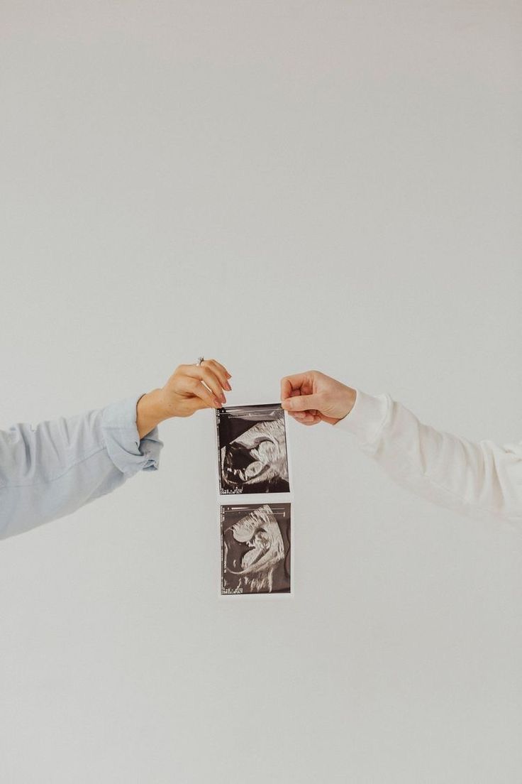 انا حامل : 13 طريقة مثالية لـ تعامل الزوج مع زوجته الحامل